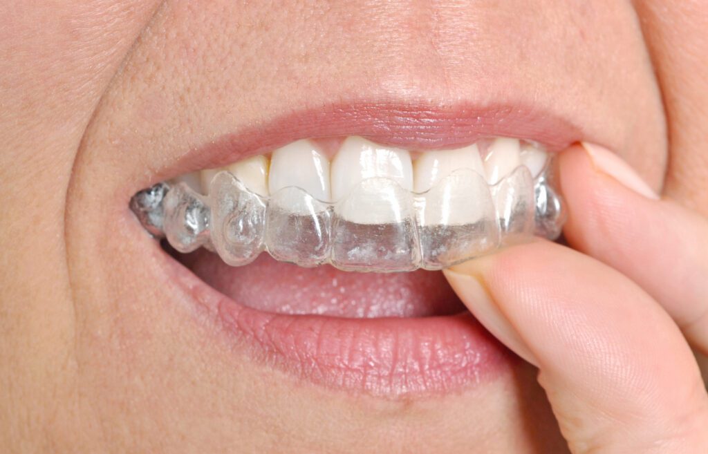 best teeth straightening dentists Clifton Hill