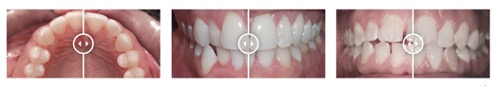 affordable orthodontist Northcote